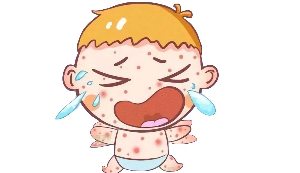 如何改善荨麻疹湿疹过敏体质,秋天季节性荨麻疹最快治疗方法