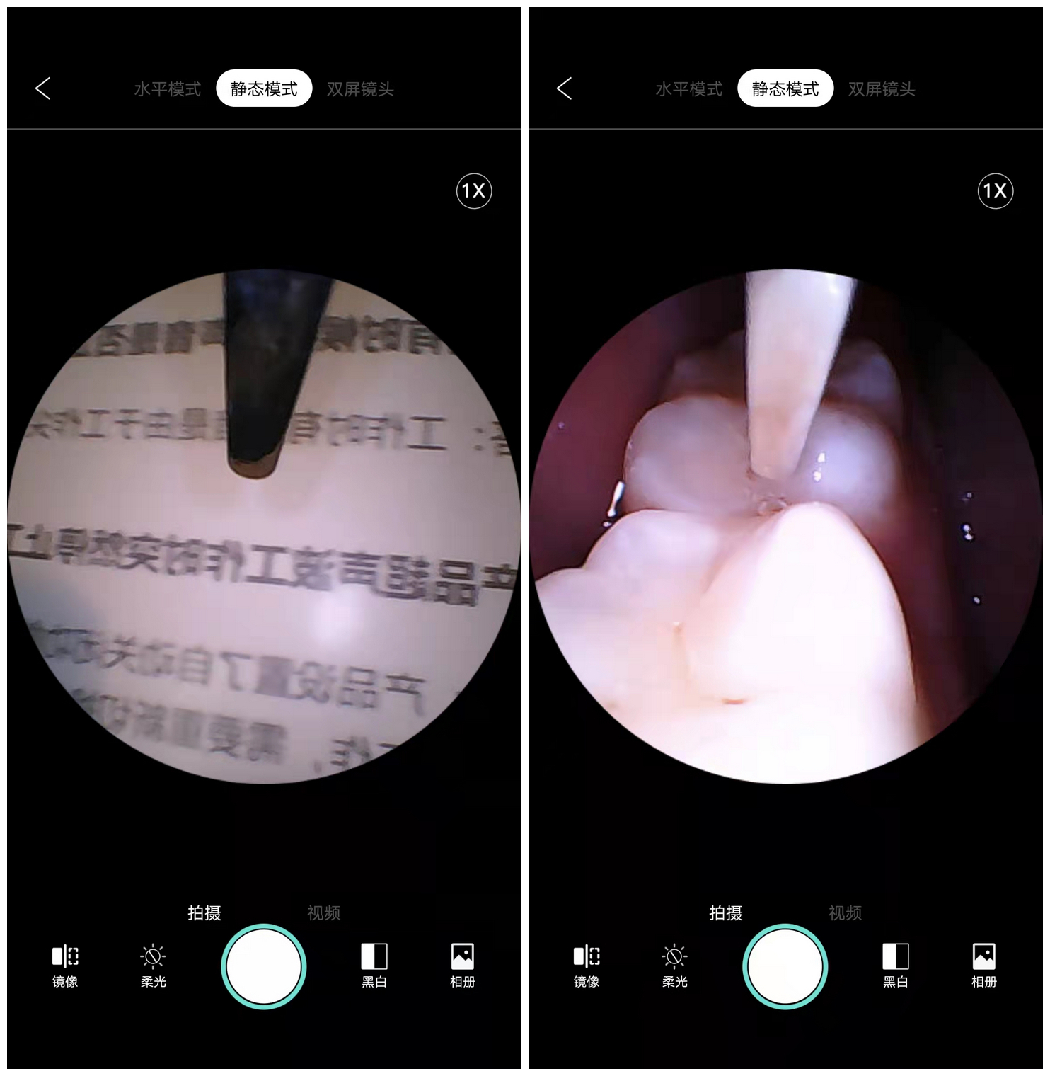 素诺智能可视超声波洁牙仪测评:不止洁牙,还能发现隐藏的牙病