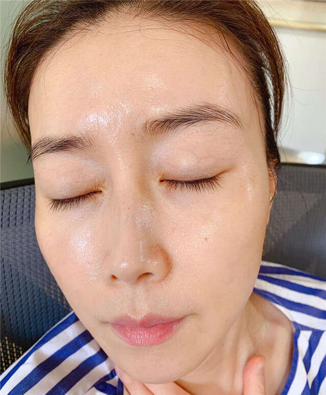 脸上闭口粉刺怎么治疗,脸上闭口粉刺怎么才能彻底处理