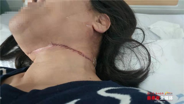 事发*安泰**！女子骑电动被风筝线割伤，割喉伤处缝补30多针
