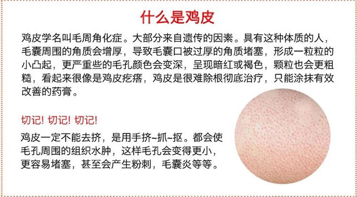 上臂外侧长疙瘩是什么原因,手臂两侧有对称的鸡皮怎么回事