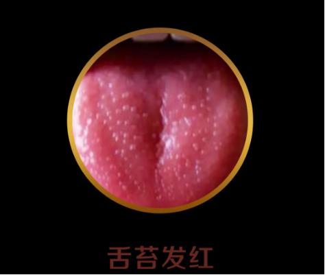 如何通过舌苔判断宝宝健康,中医教你从14种舌头的舌象看健康