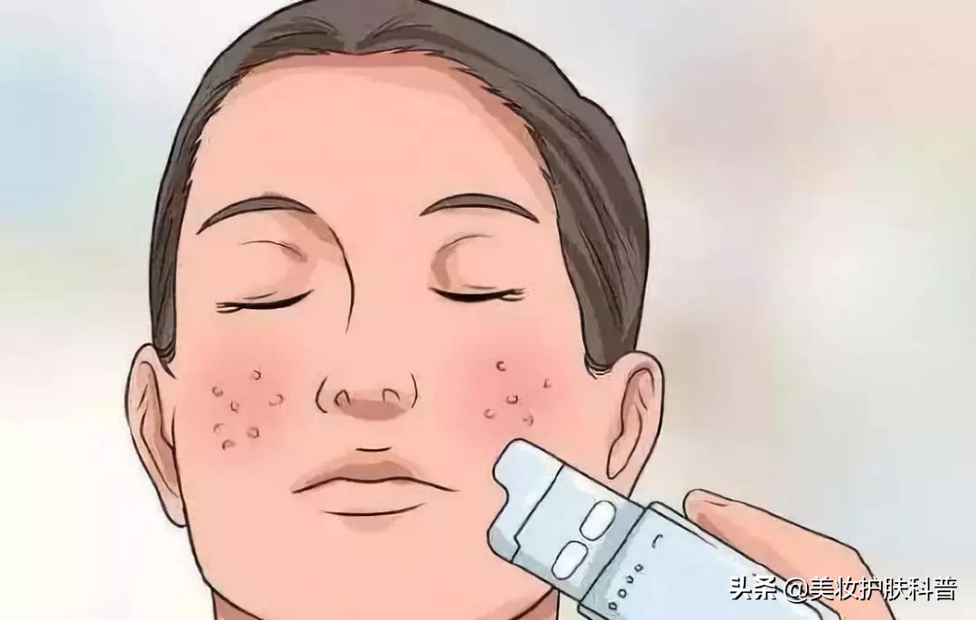 毛孔粗大收缩毛孔最快有效的方法,毛孔粗大怎么办教你一招收缩毛孔