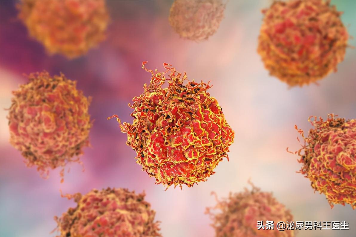 前列腺增生和前列腺肥大哪种严重,前列腺增生需要切除整个前列腺吗