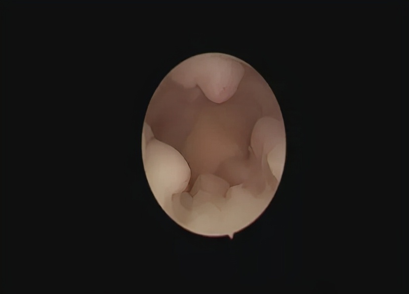 女性做amh检查要注意什么,女性检查必做项目以及时间