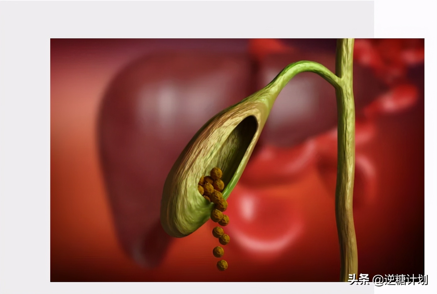 长时间不吃饭会结石吗,长时间不进食会消耗体内脂肪吗