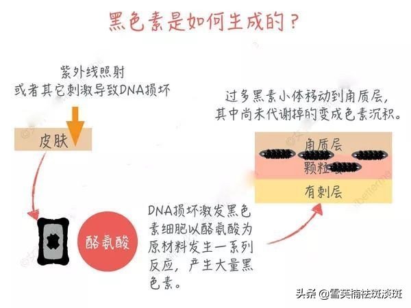 祛斑产品是交智商税吗,577祛斑是智商税吗