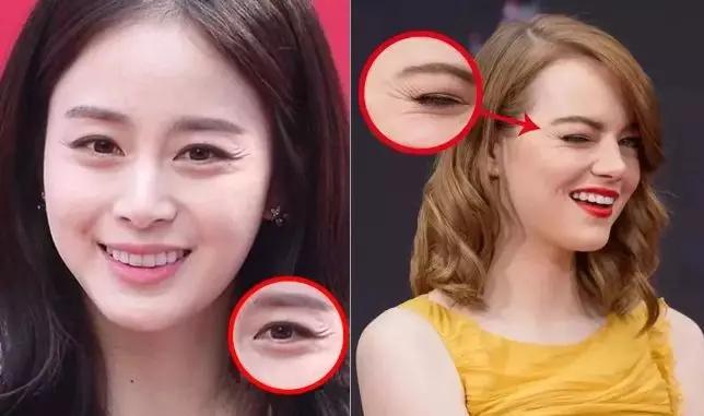 去眼纹去黑眼圈用什么方法,去眼袋眼纹公认最好用的土方法