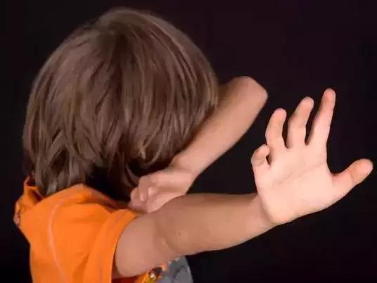 牙齿矫正别轻易拔牙,牙齿矫正要拔牙