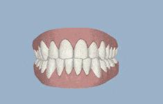 后摄像头拍照脸歪嘴歪怎么办,拍照脸歪嘴歪与现实一样吗