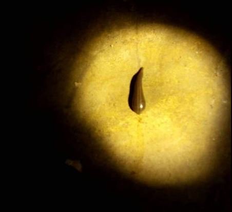 女子在河边泡脚被水蛭咬,被水蛭咬血流不止