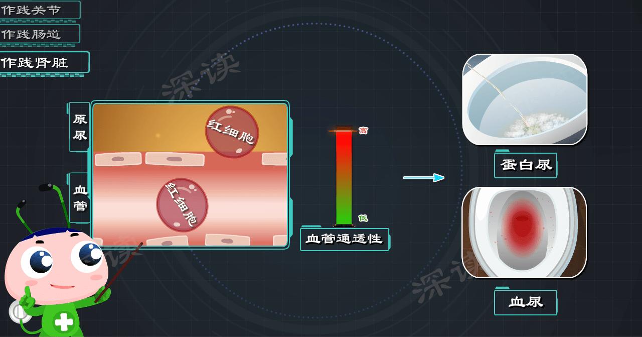 肾性过敏性紫癜多久出现血尿,肾型过敏性紫癜出现血尿时间