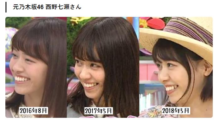 牙齿不整齐的日本女孩,日本人牙齿不齐怎么回事