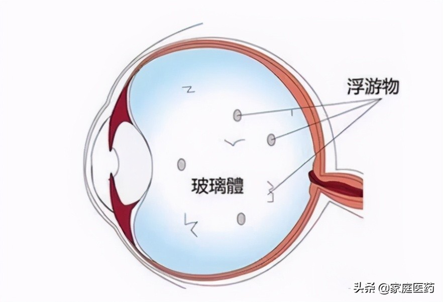 华北地区出现小虫子,东北糖尿病高发地区