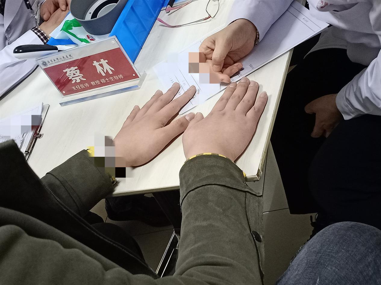 北大医院罕见病会诊,北大专家谈治疗