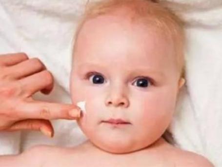 宝宝湿疹快速消除的小妙招,宝宝湿疹10个小妙招