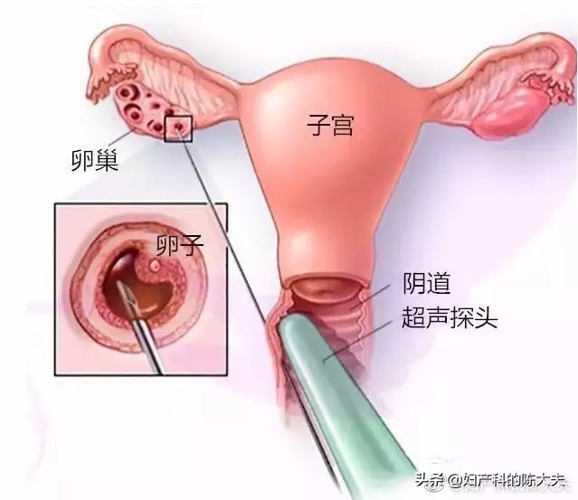 女性试管成功率多大,试管婴儿女性要遭受多大的罪