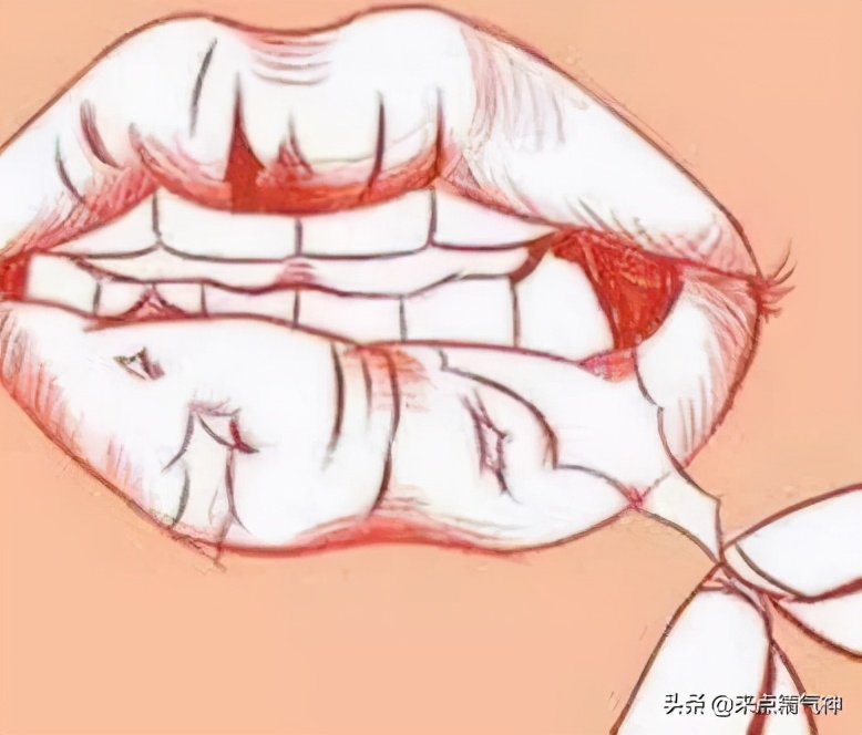 牙疼口臭是肝火还是胃火,口臭牙龈长泡是胃虚火还是胃实火