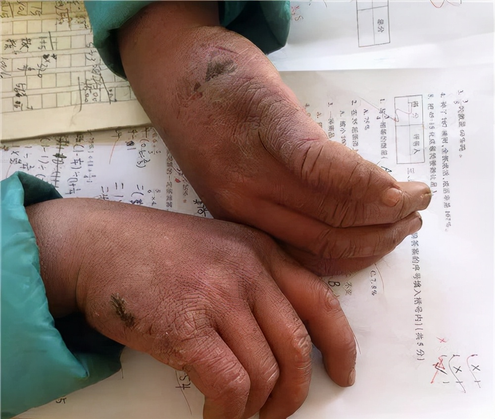 冰花男孩王福满的照片,冰花男孩王福满