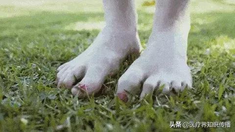 脚气怎么不用药治疗,鳞屑角化型脚气可以彻底治愈吗