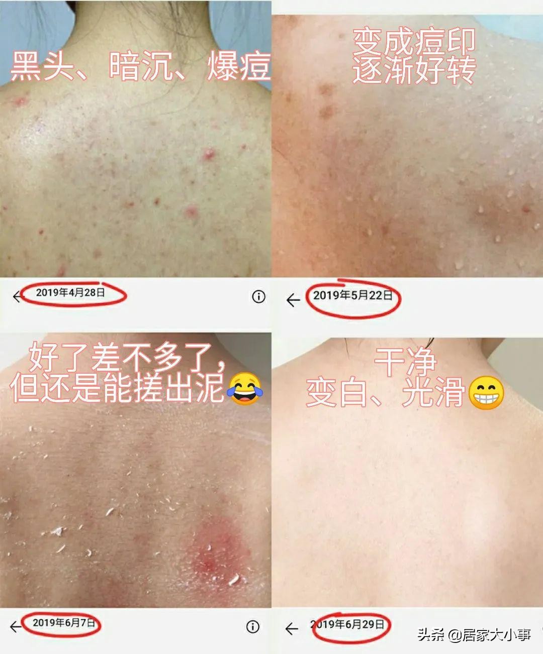 热卖搓澡巾,强力搓泥搓澡巾包邮