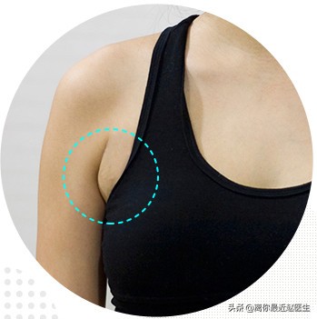 为什么医生不建议做乳腺按摩,有副乳腺怎么治