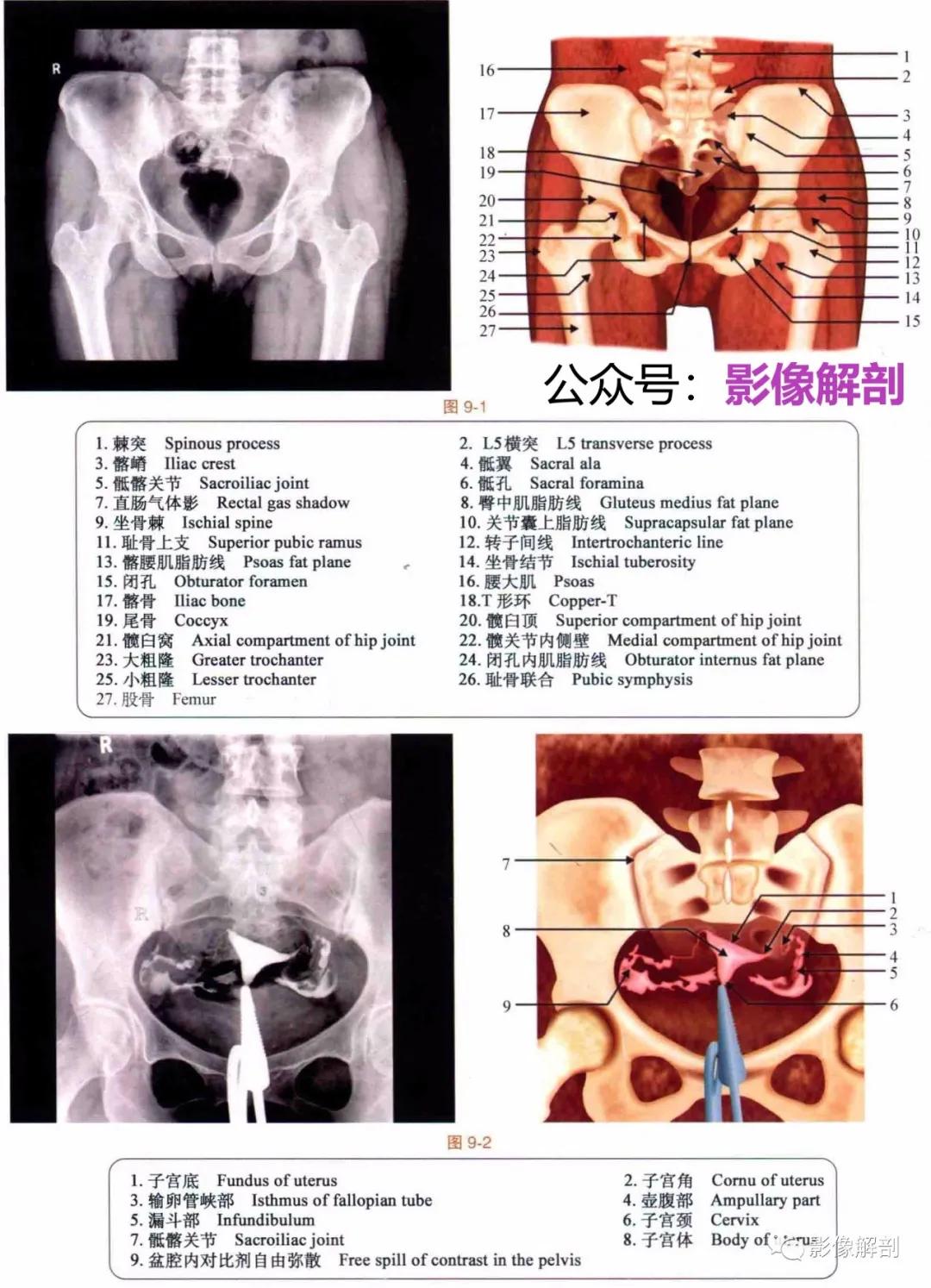 女性盆腔矢状位断层解剖,男性盆腔磁共振断层图谱