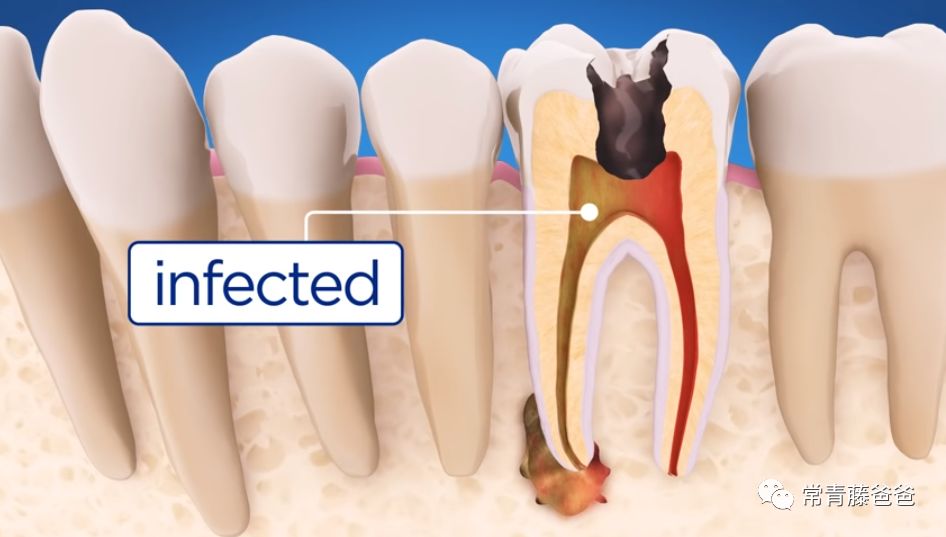 爱牙日保护你的口腔健康,爱牙日从定期口腔检查开始
