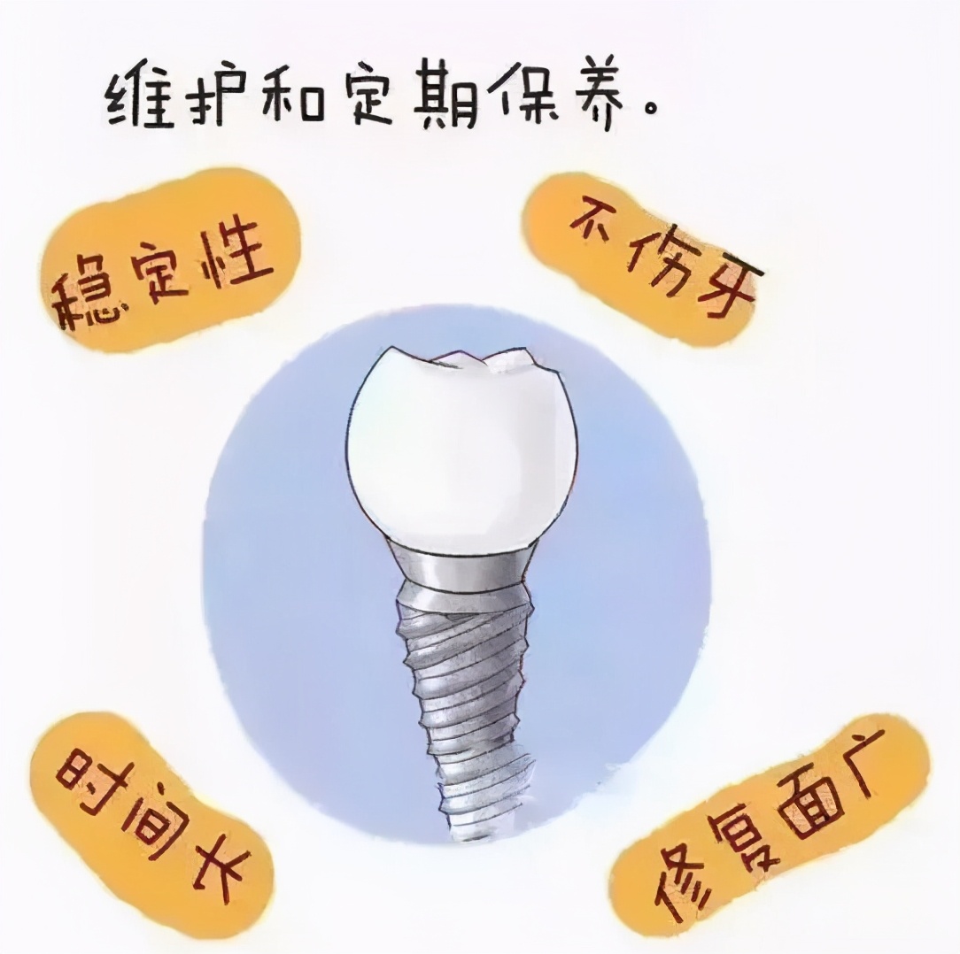 牙坏了怎么办？种植牙原来还有这些“讲究”！