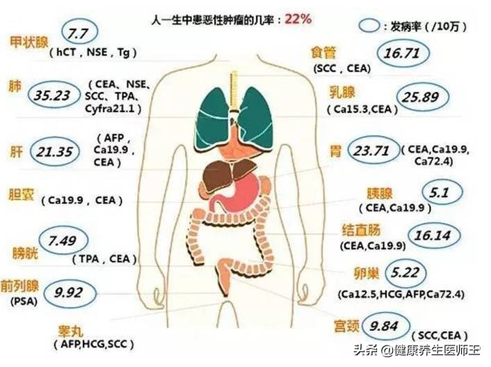 肿瘤标志物筛查多少钱,肺肿瘤标志物有哪几项