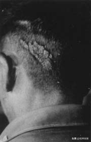 你的胎记在哪个位置看出你的含义,你的胎记在哪里找