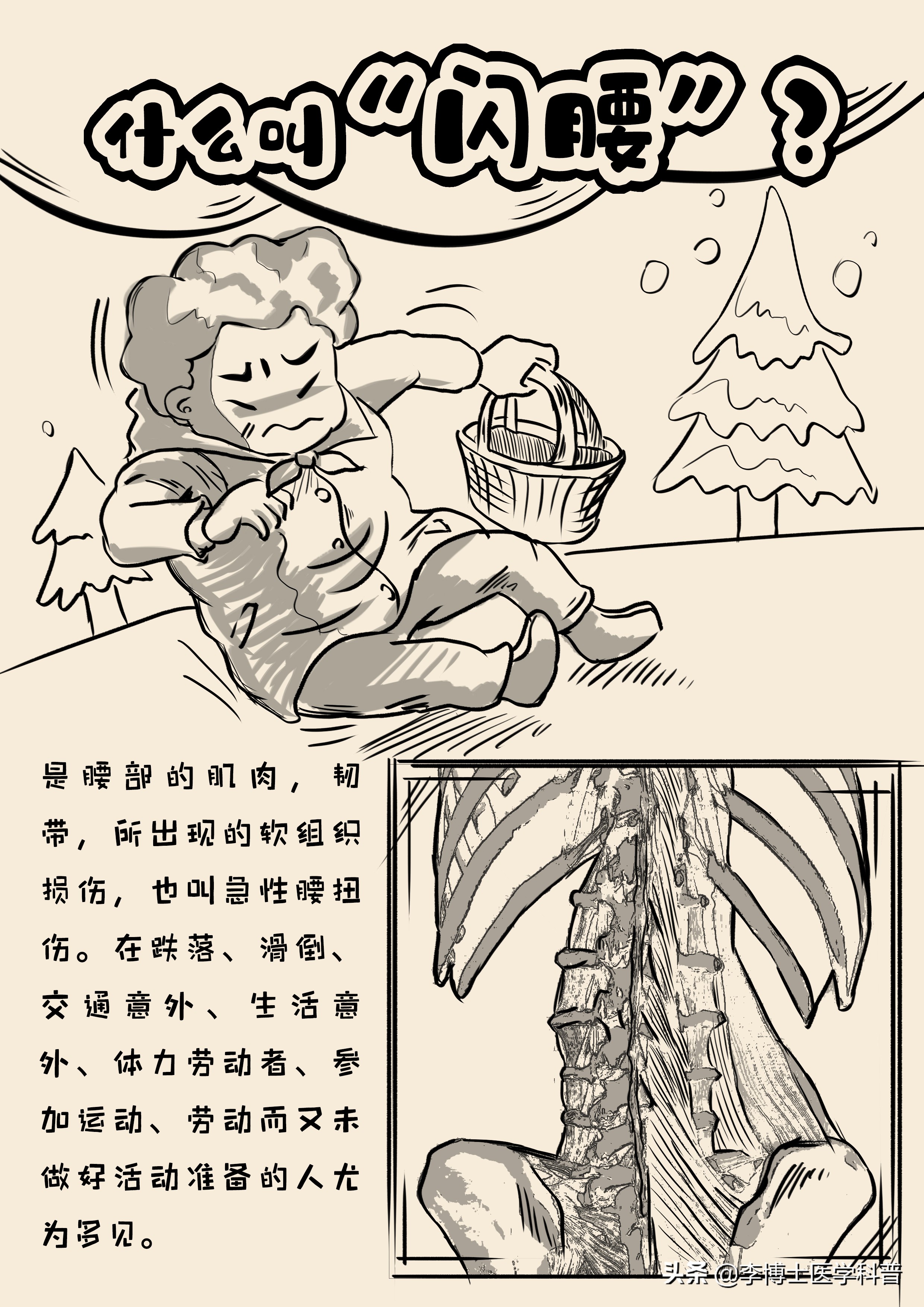 闪腰后的正确处理方法,闪腰处理方法