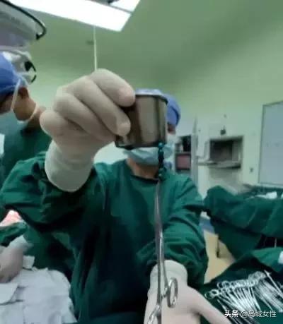 8岁男孩误吞5厘米钢钉,惊险9岁男孩误吞3厘米图钉