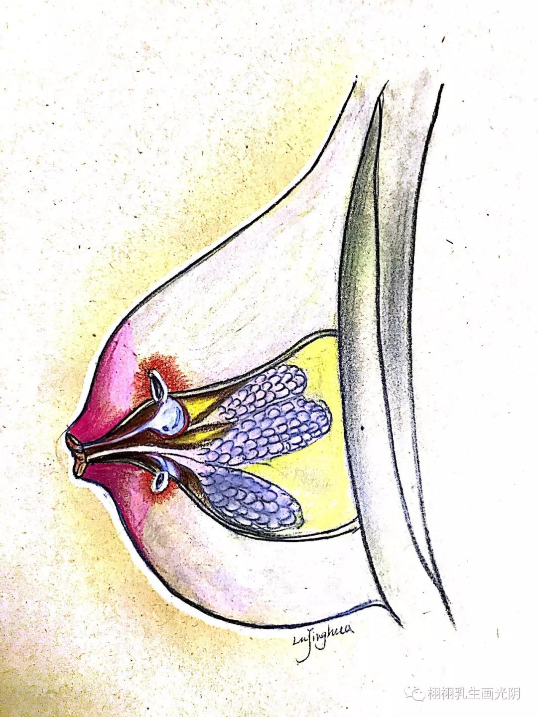 乳腺炎的6大现象,怎么确定是真正的乳腺炎