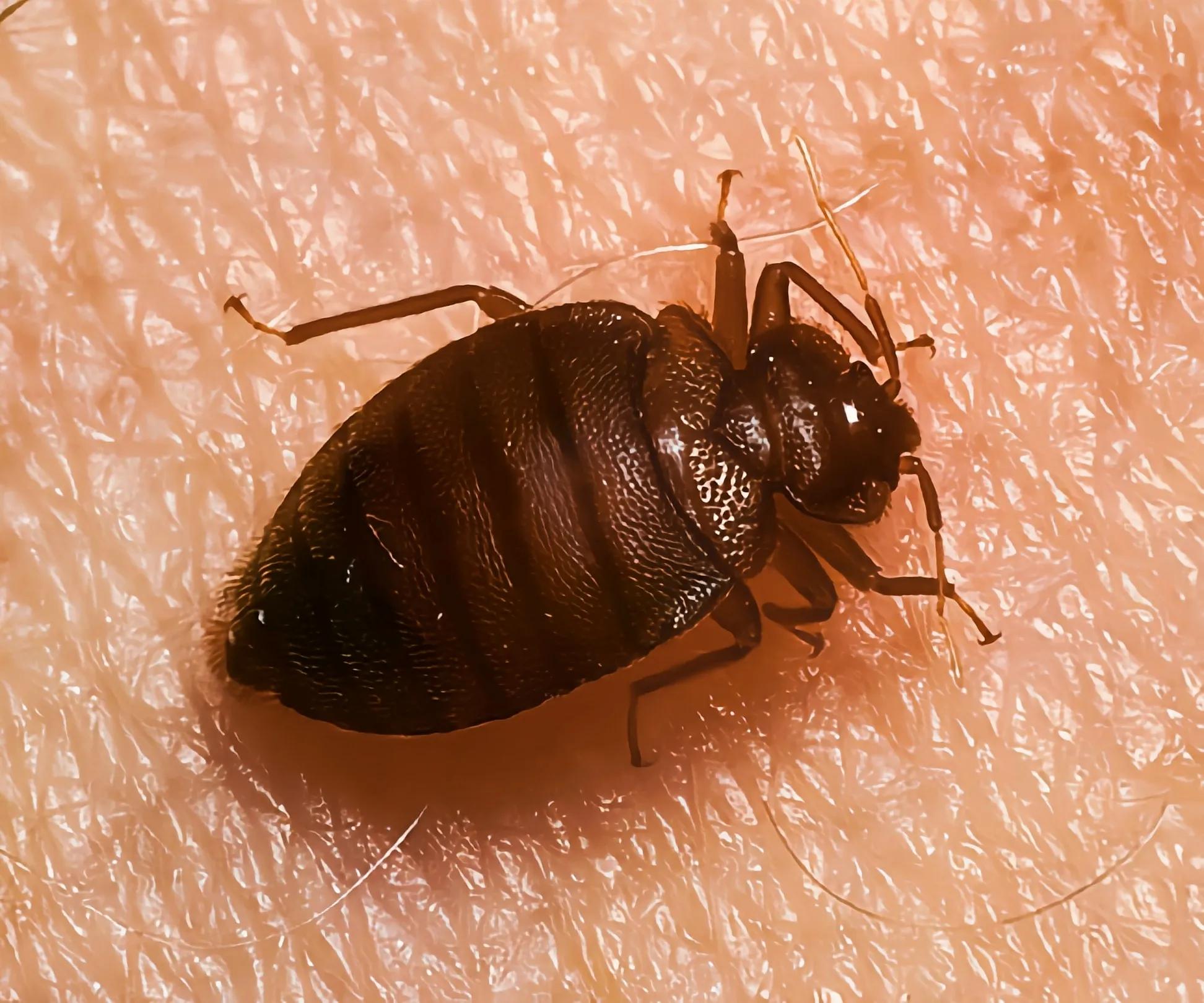 孩子蚊虫叮咬止痒药膏,蚊虫叮咬后眼睛肿怎么办