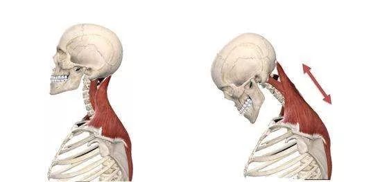 骨科医生颈椎变直怎么办,颈椎曲度变直要看什么科