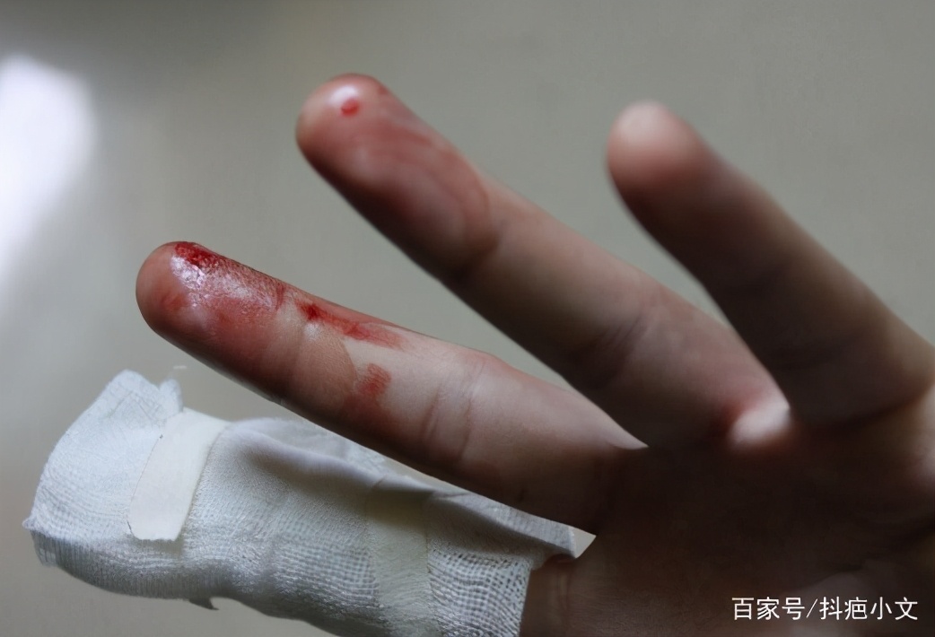 小孩经常受伤怎么办,孩子不小心受伤情况有哪些