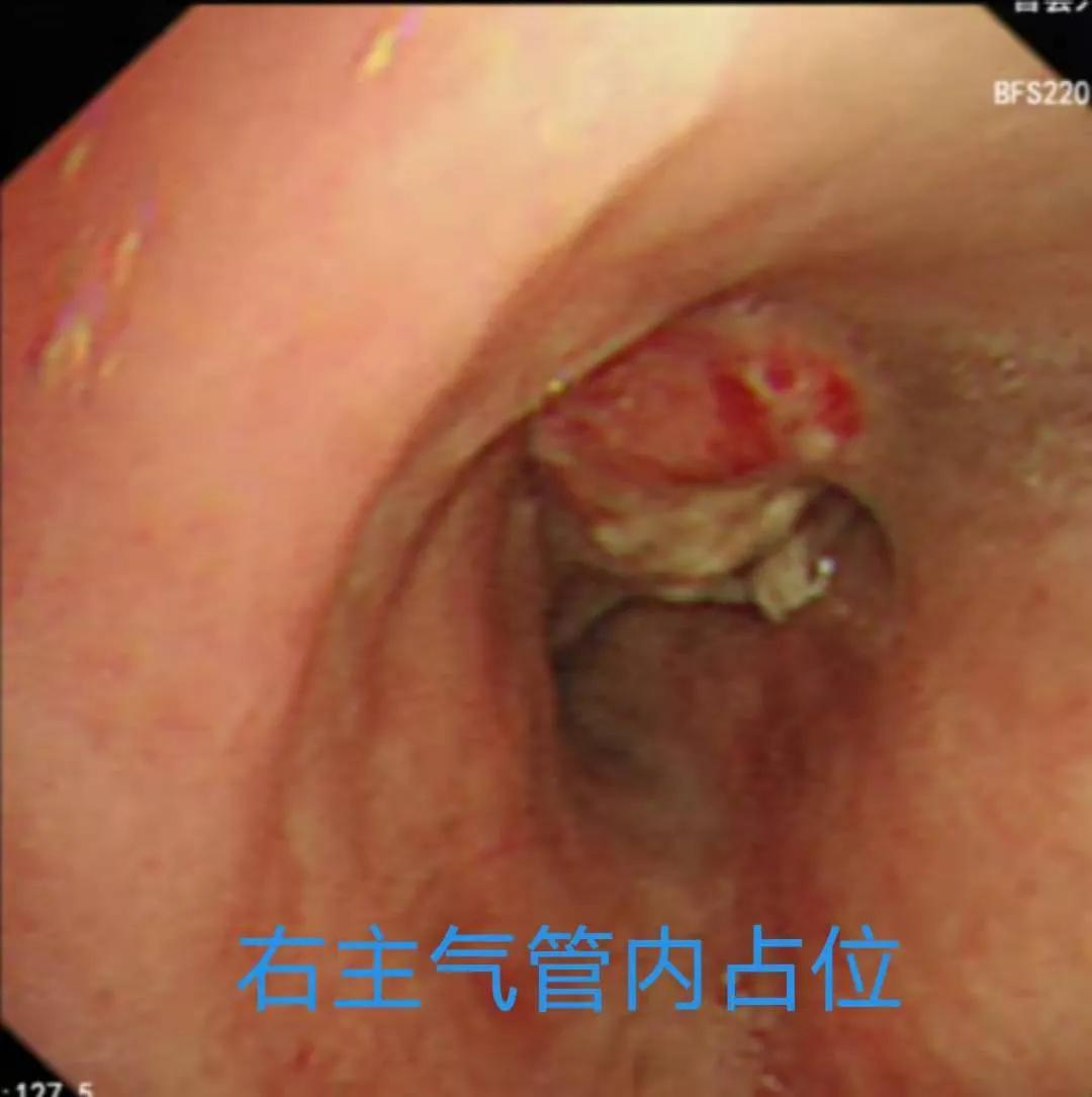 光动力:黑暗中的曙光文/张奎松冯炳振