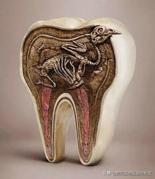 牙齿出现龋齿怎么解决视频,出现龋齿怎么办