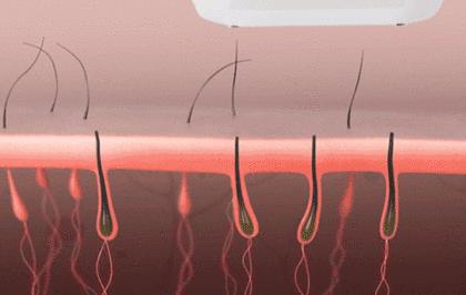 夏天穿毛衣毛裤好吗,夏天毛衣毛裤