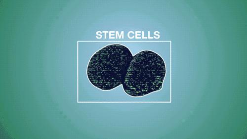 干细胞治疗脑中风后遗症最新消息,干细胞治疗脑中风多长时间有效啊
