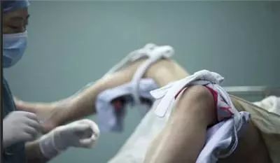 20岁女孩第四次人流,二十一岁女孩人流五次