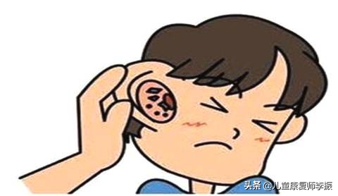 耳朵后面总有白色分泌物,宝宝耳朵有白色分泌物用什么药