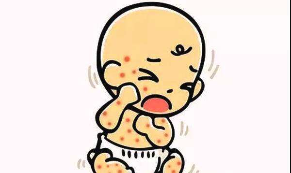 小儿湿疹会不会一直出汗,2个月的小儿湿疹反反复复