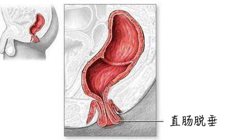 2个娃身上突然多处淤青，到底是谁虐的？