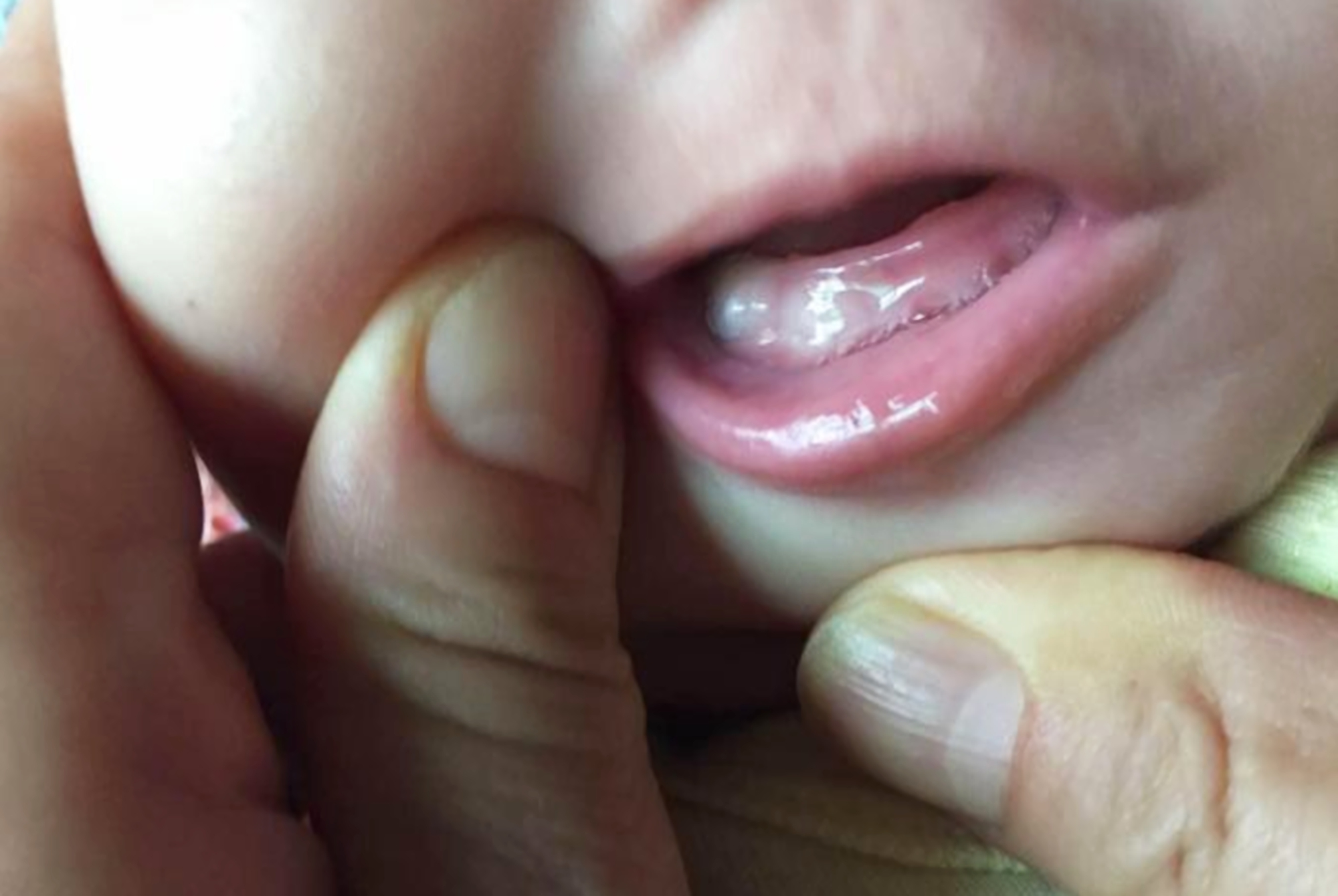 宝宝出牙早晚和咀嚼发育有关，安排好辅食添加，牙齿才能长得好