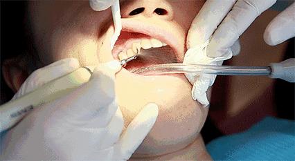 除牙结石美白防口臭的牙膏测评,马卡龙牙膏刷的干净吗