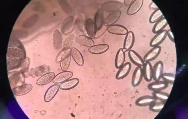 宝宝喜欢挠屁股,宝宝总是挠屁股是有虫子吗