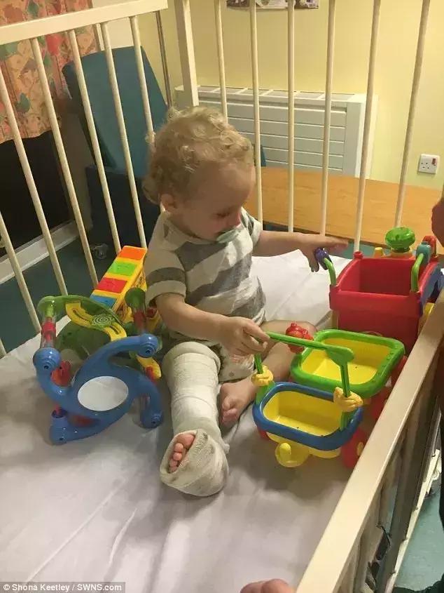 孩子在滑滑梯头朝下滑导致骨折,小孩玩滑梯骨折了怎么办