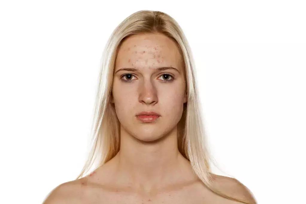 医学上脸皮厚的好处和坏处,皮肤科医生皮肤变好的4个习惯